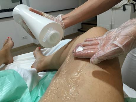 ¿Cómo funciona la Criolipólisis? Mi primer tratamiento en ICE Aesthetic Barcelona criolipolisis sesion