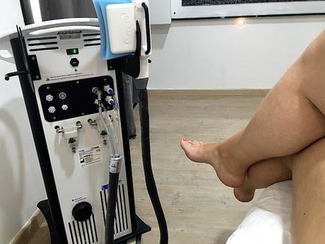 ¿Cómo funciona la Criolipólisis? Mi primer tratamiento en ICE Aesthetic Barcelona criolipolisis barcelona