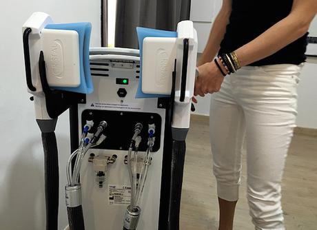 ¿Cómo funciona la Criolipólisis? Mi primer tratamiento en ICE Aesthetic Barcelona Cómo funciona la Criolipólisis