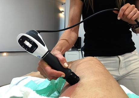 ¿Cómo funciona la Criolipólisis? Mi primer tratamiento en ICE Aesthetic Barcelona cómo funciona la criolipolisis