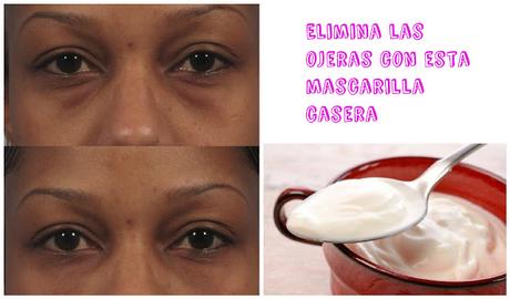 Elimina las horribles ojeras con estas 2 mascarillas caseras Elimina las horribles ojeras con estas 2 mascarillas caseras