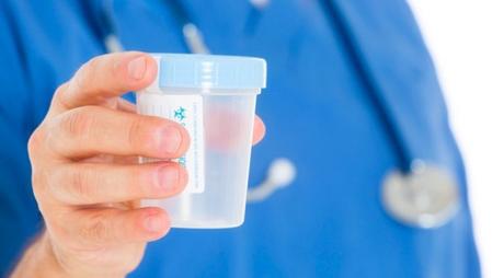 Un análisis de orina experimental predice con éxito el cáncer de próstata Un análisis de orina experimental predice con éxito el cáncer de próstata