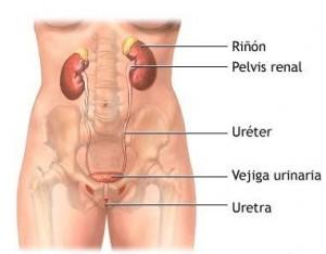 VEJIGAURETERRIÑON 1 300x234 Tratamiento para cuando hay sangre en la orina   I