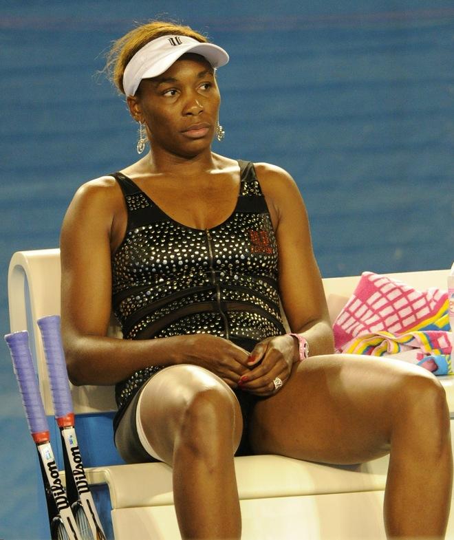 Australian Open: Venus no aguantó, y se despidió por lesión Australian Open: Venus no aguantó, y se despidió por lesión