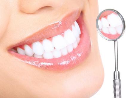 Blanqueamiento de dientes: ¿Es una estafa? Blanqueamiento de dientes: ¿Es una estafa?