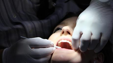 Implantes dentales todo lo que debes saber
