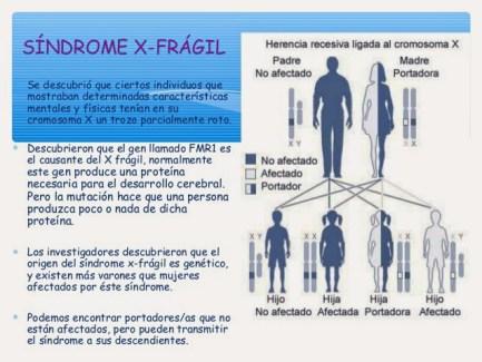 sndrome-x-fragil-4-638