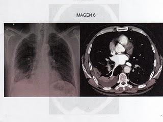 Proyecto MIR 2.0: preguntas de Anestesia y críticos Proyecto MIR 2.0: preguntas de Anestesia y críticos