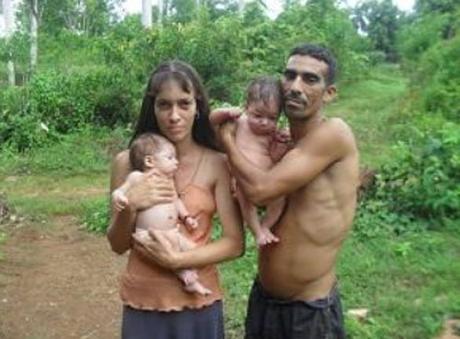 Un “nutriente” llamado CHISPITAS combate la anemia en Cuba. pobrezabebes
