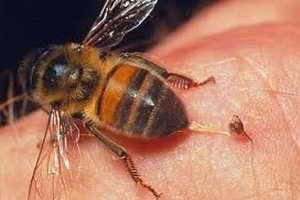 Picotazos de abejas para sanar - Bee stings to heal