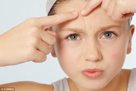 Conoce las razones por las cuales no debes reventarte las espinillas #Salud Conoce las razones por las cuales no debes reventarte las espinillas #Salud