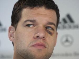 OJO-NEGRO-Ballack-conferencia-prensa_CLAIMA20100302_0009_15 OJO NEGRO Ballack conferencia prensa CLAIMA20100302 0009 15 300x225 Homeopatía para tratar un ojo morado o golpeado