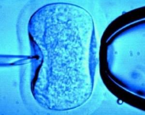 fiv fiv 300x237 La fecundación in vitro se comparte en las redes sociales