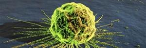 Sobrevivir a la epopeya: de cómo afectan la estética y la ética imperantes a las vivencias del cáncer Sobrevivir a la epopeya: de cómo afectan la estética y la ética imperantes a las vivencias del cáncer