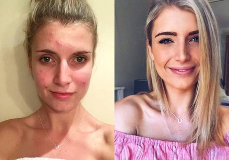 Esta celebridad de Instagram se mostró sin maquillaje para que todos la conozcan tal cual es Esta celebridad de Instagram se mostró sin maquillaje para que todos la conozcan tal cual es