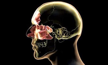 Granulomatosis de Wegener: diagnóstico y tratamiento