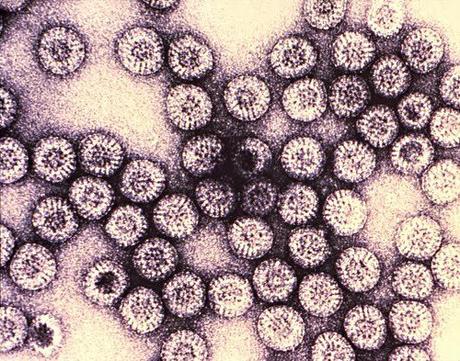 Los 9 virus más mortales de la Tierra