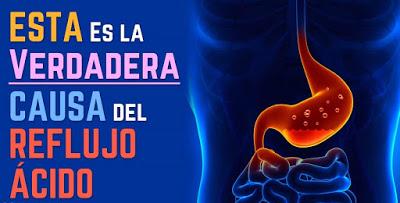 Top 10 de alimentos que causan acidez estomacal Top 10 de alimentos que causan acidez estomacal