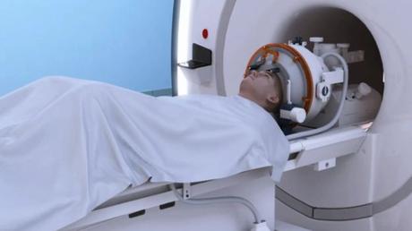 Sin bisturí ni anestesia: La increíble cirugía cerebral con ondas de sonido que curó a un paciente con temblores Sin bisturí ni anestesia: La increíble cirugía cerebral con ondas de sonido que curó a un paciente con temblores