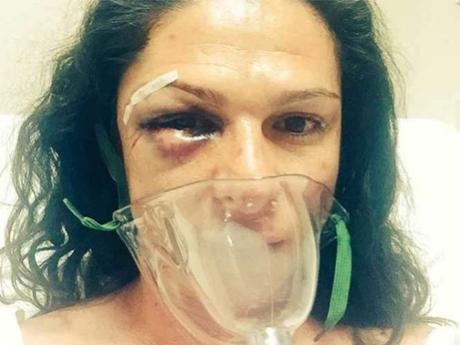 Ana Gabriela Guevara: Cuatro hombres me golpearon de la manera más cobarde