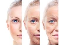 BUEN BOTOX Y MAL BOTOX: CÓMO DIFERENCIARLO BUEN BOTOX Y MAL BOTOX: CÓMO DIFERENCIARLO