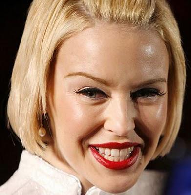 ¿Qué es el botox? ¿Qué es el botox?
