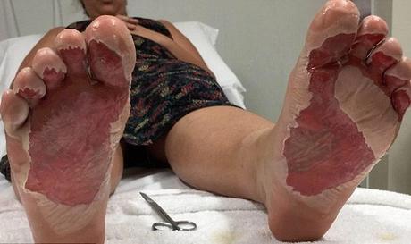 Después de ver estas imágenes lo pensarás dos veces antes de caminar descalzo en la playa 3b96223d00000578-0-image-a-7_1482448299590