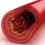 Propóleo para hacer frente al invierno Propóleo para hacer frente al invierno