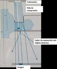 MAMOGRAFIA PROYECCIONES COMPLEMENTARIAS