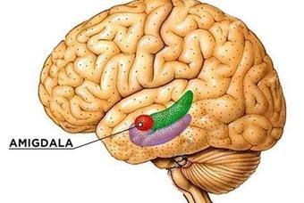 El Autismo estaria relacionado con la Amigdala Cerebral