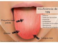 La lengua y la salud..Según la forma y el color.