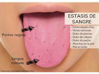 La lengua y la salud..Según la forma y el color.