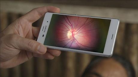 La app revolucionaria que diagnostica problemas oculares.