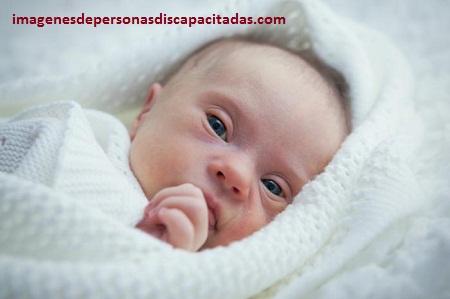 cuidados para niños con sindrome de down bebes cuidados para niños con sindrome de down bebes