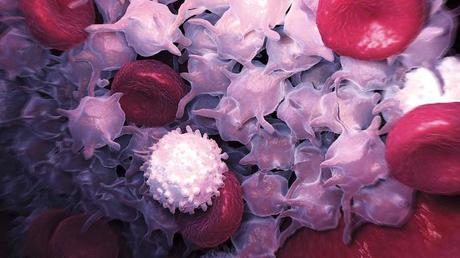 Alto conteo de glóbulos blancos Alto conteo de glóbulos blancos