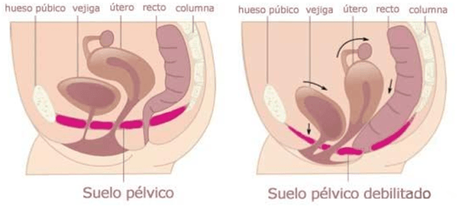 ¿Cómo rehabilitar el suelo pélvico tras el parto? ¿Cómo rehabilitar el suelo pélvico tras el parto?