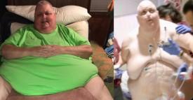 Sufrimiento innecesario: vivió 15 años con un tumor de 59 kilos