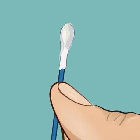 La cera de los oídos puede decir mucho sobre tu salud La cera de los oídos puede decir mucho sobre tu salud