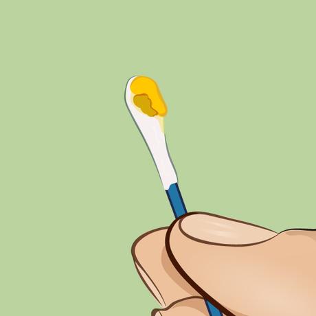 La cera de los oídos puede decir mucho sobre tu salud La cera de los oídos puede decir mucho sobre tu salud