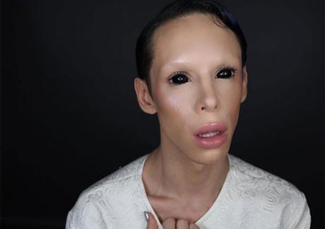 Este joven ha pasado por 115 cirugías para ser un “marciano asexuado”(FOTOS) Este joven ha pasado por 115 cirugías para ser un “marciano asexuado”(FOTOS)