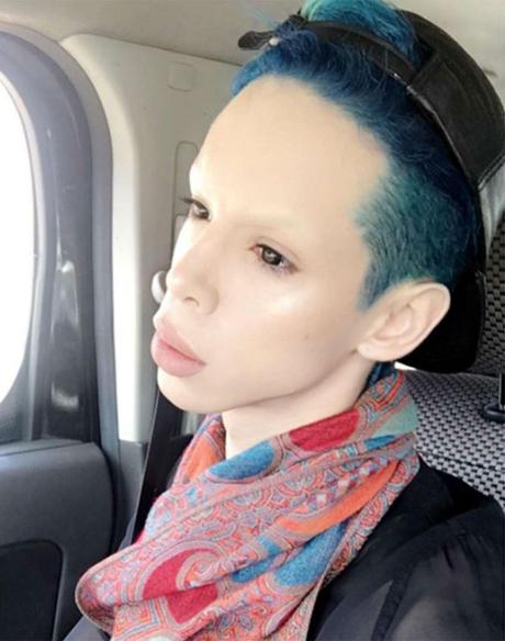 Este joven ha pasado por 115 cirugías para ser un “marciano asexuado”(FOTOS) Este joven ha pasado por 115 cirugías para ser un “marciano asexuado”(FOTOS)