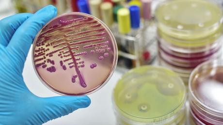 La OMS publicó una lista de bacterias resistentes a los antibióticos