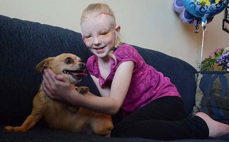 Un perrito Chihuahua enfrenta a Pitbull y salva a su dueña, una niña de 8 Años #Historias #Perros #Mascotas (FOTO)