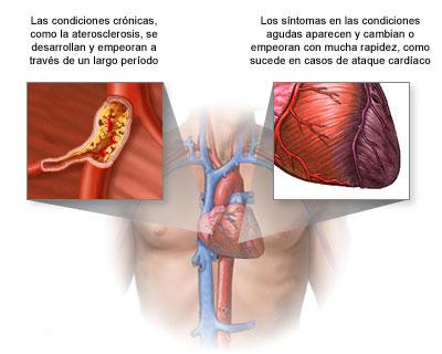 Cor pulmonale Causas del cor pulmonale