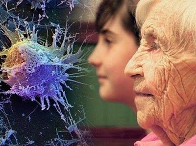 Algunos cerebros envejecen más rápido Algunos cerebros envejecen más rápido