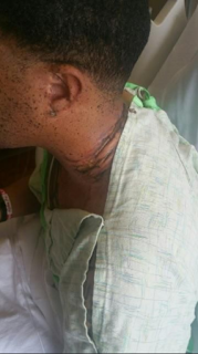 Hombre sufre severas quemaduras por dormir junto a su iPhone Hombre sufre severas quemaduras por dormir junto a su iPhone