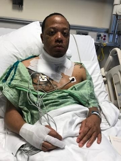 Hombre sufre severas quemaduras por dormir junto a su iPhone Hombre sufre severas quemaduras por dormir junto a su iPhone