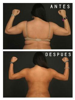 Caso de negligencia médica en anestesia Nº 3: Muerte de una modelo Caso de negligencia médica en anestesia Nº 3: Muerte de una modelo