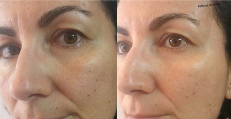 Antes y despues Antes_despues