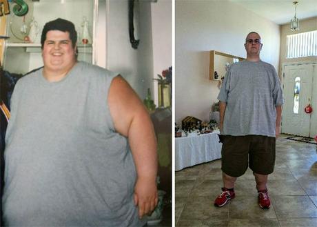 Casos de personas antes y después de perder peso tan...